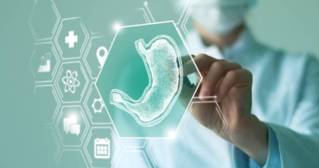 Advanced GI MIS and Bariatric Surgery